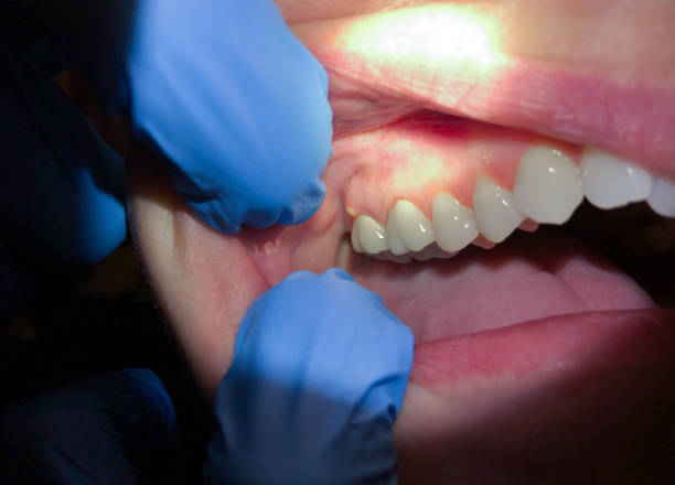 Best Emergency TMJ Treatment in Paw Paw Lake, MI